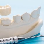 Tailored SEO Strategies for Growing Your Dental Practice